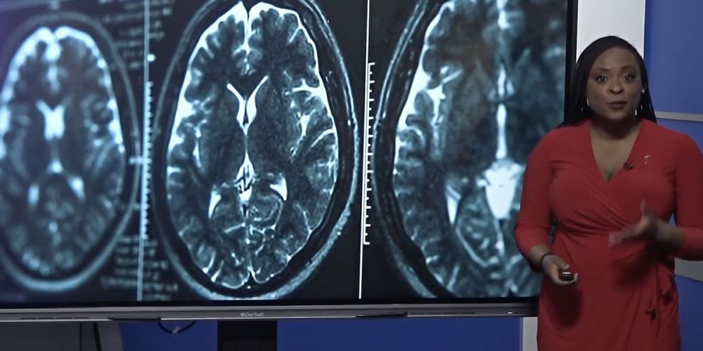 Alzheimer’s Clinical Trials in Need of More Black Participants